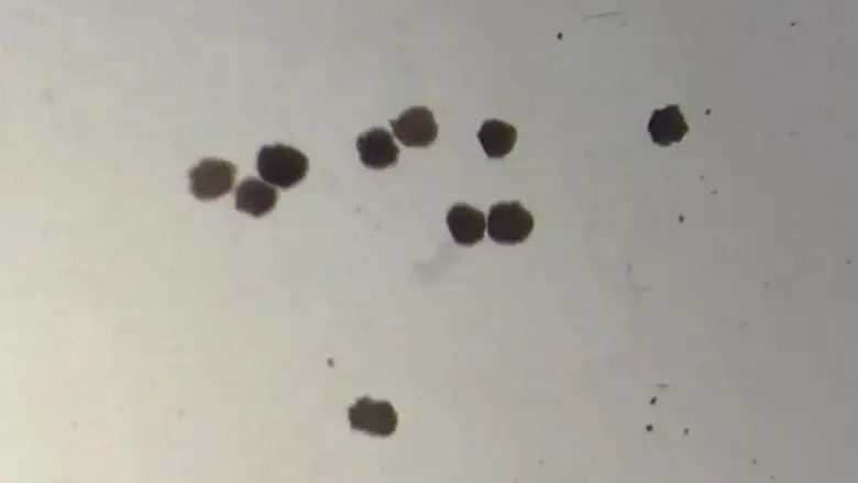 Anthrobots How Tiny Robots Made from Human Cells Are Revolutionizing Medicine